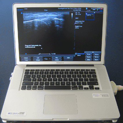 Image: The t3200 MSK series ultrasound system (photo courtesy of Terason).